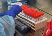 Coronavirus, D’Amato: “Oggi nel Lazio 977 casi positivi, 16 decessi e +817 guariti”