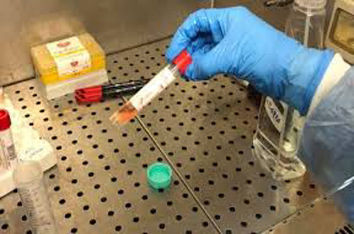 coronavirus asl viterbo