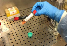 Coronavirus, D’Amato: “Oggi nel Lazio 1.519 casi positivi, 24 decessi e +1.706 guariti”