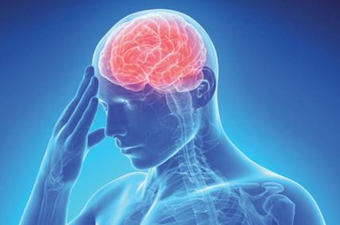 belcolle neurologia d'urgenza