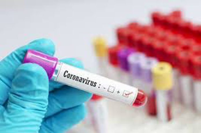 coronavirus_aslvt