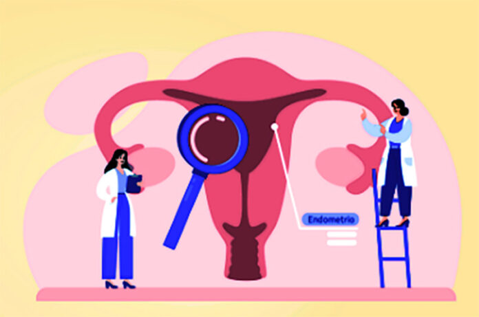 Giornata endometriosi