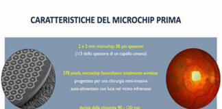 Microchip nella retina, 80% pazienti sottoposti a trial clinico tornato a leggere Cusumano (Tor Vergata) in team internazionale: entro 2026 possibili primi impianti in Italia Microchip retina