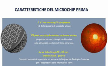 Microchip retina