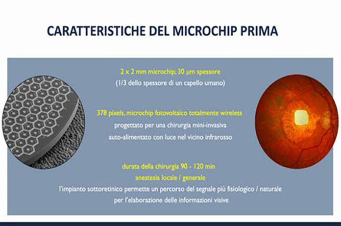Microchip retina Microchip retina
