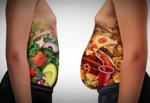 giornata mondiale dell'obesità 4 marzo